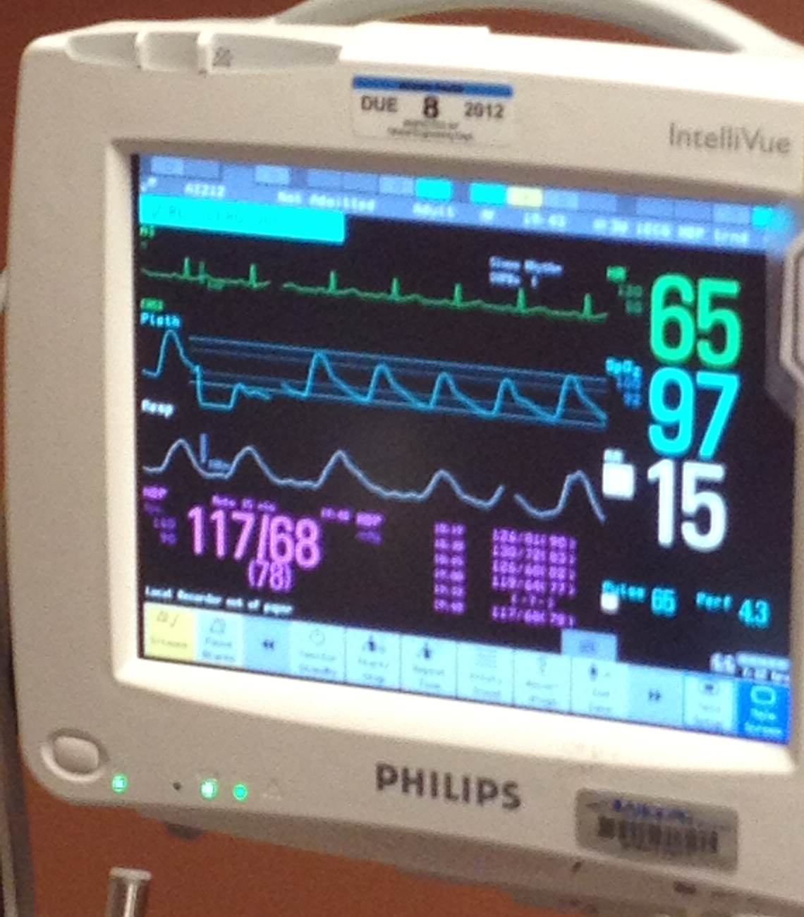 Patient's vital statistics on screen